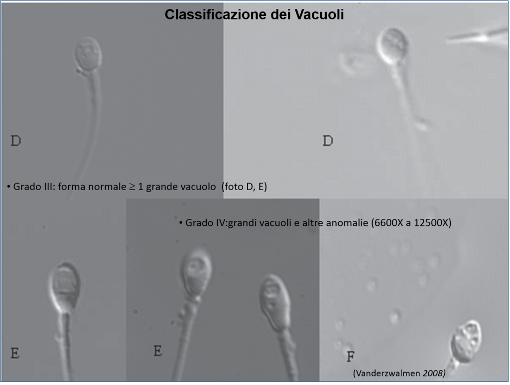 Classificazione dei Vacuoli_1
