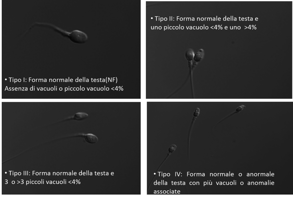 Classificazione dei Vacuoli_EH
