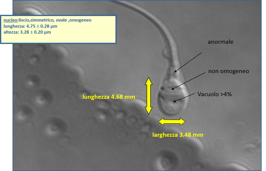 Valutazione dello spermatozoo ed in particolare dei vacuoli intranucleari